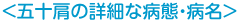 五十肩の詳細な病態・病名