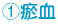 瘀血