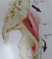 大腰筋側面像