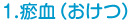 瘀血（おけつ）